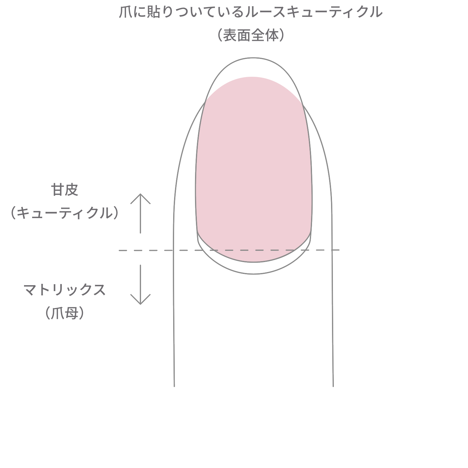 キューティクルケア