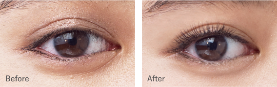 Before After