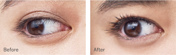 Before After