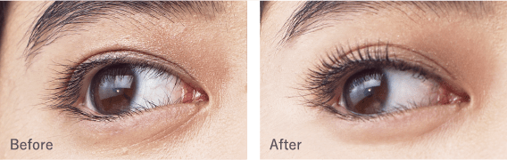 Before After